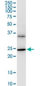 BDNF Antibody in Western Blot (WB)