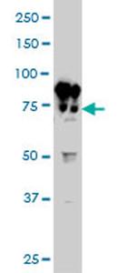 BFSP1 Monoclonal Antibody (6B4)