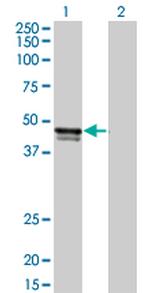 BGN Monoclonal Antibody (2E6-D1)