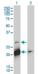 BID Monoclonal Antibody (3F3-1A3)