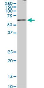 BLK Antibody in Western Blot (WB)