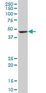 BLMH Monoclonal Antibody (4A2)