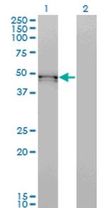 BMP7 Monoclonal Antibody (S52)