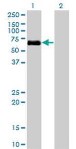 BMPR1A Monoclonal Antibody (4C4)