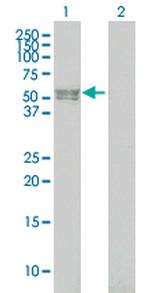 BMPR1B Antibody in Western Blot (WB)