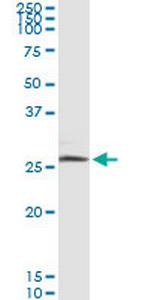BNIP3L Monoclonal Antibody (2E11)