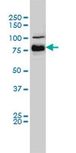 BRAF Antibody in Western Blot (WB)