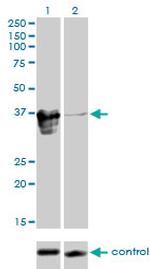 ZFP36L1 Monoclonal Antibody (1A3)