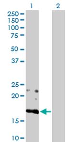 BST2 Polyclonal Antibody, MaxPab™