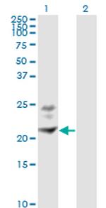 BST2 Monoclonal Antibody (3H4)