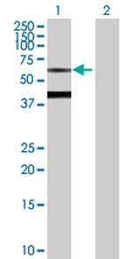 BTD Polyclonal Antibody, MaxPab™