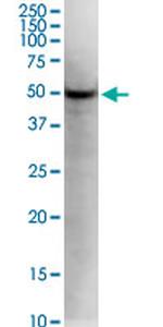 KLF5 Monoclonal Antibody (2G12)