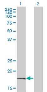 BTF3 Monoclonal Antibody (3C4-2E11)
