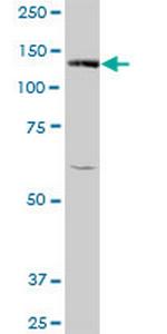 BUB1 Polyclonal Antibody, MaxPab™