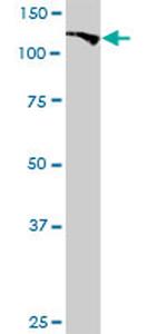 BUB1 Antibody in Western Blot (WB)