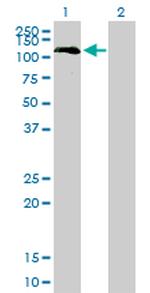 BUB1 Antibody in Western Blot (WB)