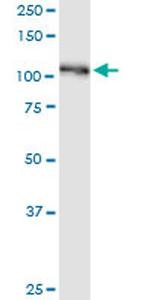 BUB1B Antibody in Western Blot (WB)