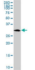 C1QBP Antibody in Western Blot (WB)