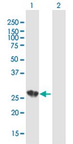 C1QA Polyclonal Antibody, MaxPab™