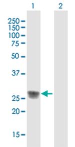 C1QA Polyclonal Antibody, MaxPab™