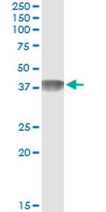 C4BPB Monoclonal Antibody (1G9)