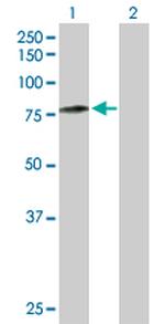 CAPN5 Polyclonal Antibody, MaxPab™