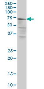 CAPN5 Antibody in Western Blot (WB)