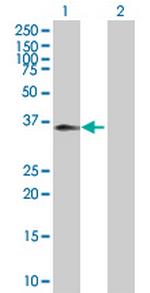 C5R1 Polyclonal Antibody, MaxPab™
