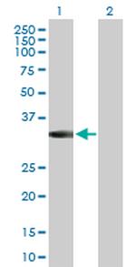 MPPED2 Polyclonal Antibody, MaxPab™