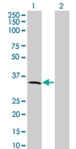 MPPED2 Antibody in Western Blot (WB)