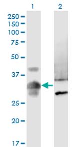 MPPED2 Monoclonal Antibody (4H5)
