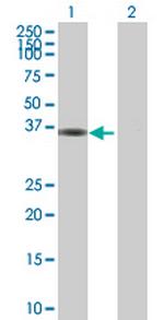 MPPED1 Polyclonal Antibody, MaxPab™
