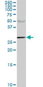 CA1 Monoclonal Antibody (M2)