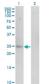 CA1 Monoclonal Antibody (7G12)