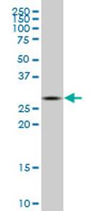 CA1 Monoclonal Antibody (10E4)