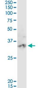 CA3 Antibody in Western Blot (WB)