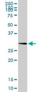 CA3 Antibody in Western Blot (WB)