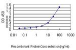 CA3 Antibody in ELISA (ELISA)
