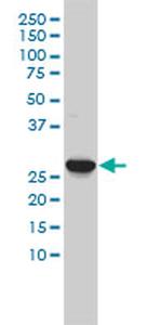 CA3 Antibody in Western Blot (WB)