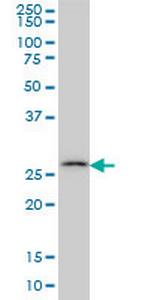 CA7 Monoclonal Antibody (3B7)