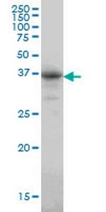 CA8 Monoclonal Antibody (1F7)