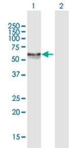CA9 Antibody in Western Blot (WB)