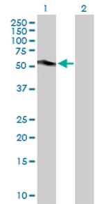 CA9 Antibody in Western Blot (WB)