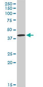 CA12 Antibody in Western Blot (WB)