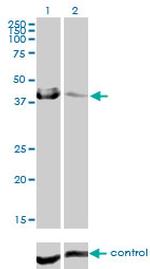 CA12 Monoclonal Antibody (1D4)