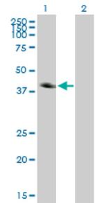 CA12 Antibody in Western Blot (WB)