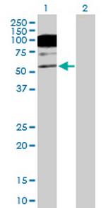 CACNB1 Polyclonal Antibody, MaxPab™