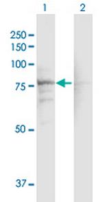 CACNB1 Polyclonal Antibody, MaxPab™