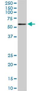 CACNB2 Monoclonal Antibody (6C1)