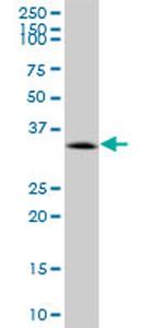 CACNG1 Antibody in Western Blot (WB)